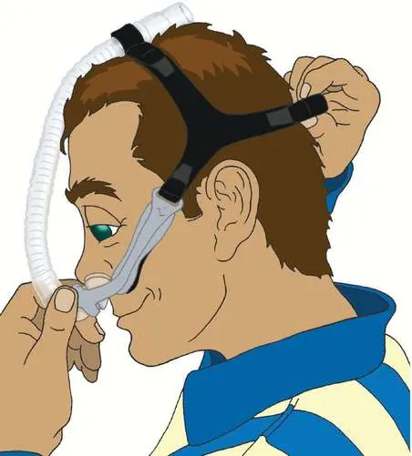 Initial placement of the mask and headgear