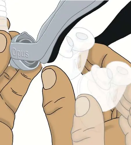 Removing the nasal pillow assembly