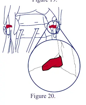Locking the car seat into the stroller frame