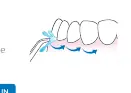Correct flossing technique