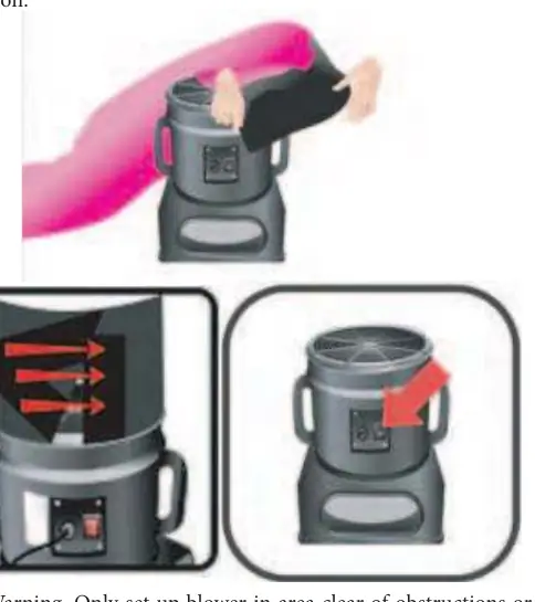 Setup and attachment procedure