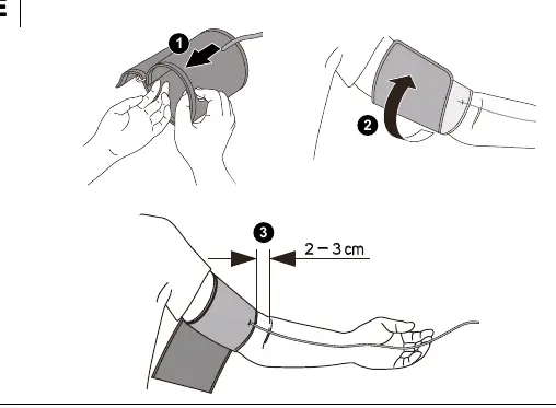 Cuff placement (Diagram E)