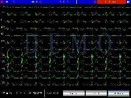 Sampling interface display