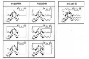 Lead system diagram