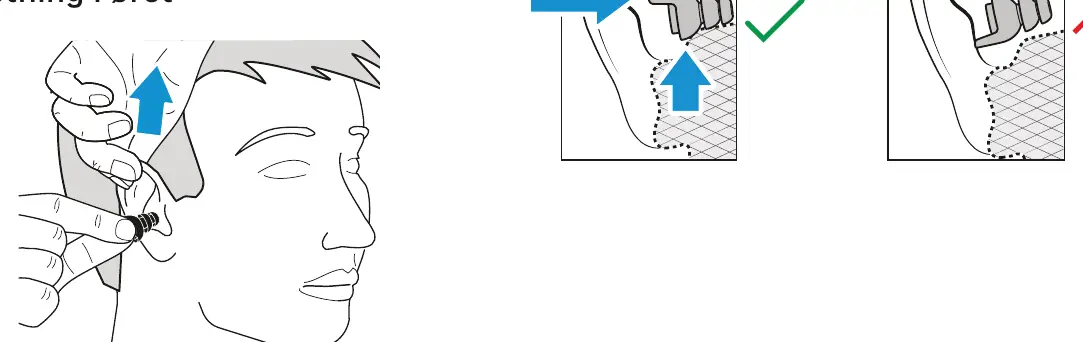 Proper insertion technique