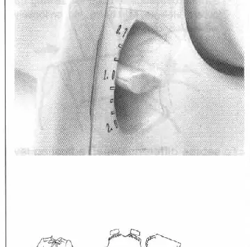 Differential feed adjustment lever
